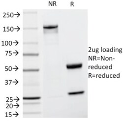 Cyclin D1 Antibody (CCND1/809), Novus Biologicals 0.2mg; Unlabeled:Antibodies,